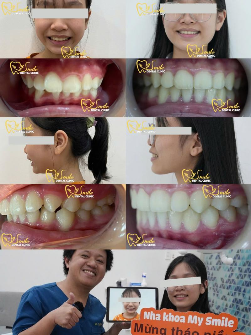 Nha Khoa My Smile