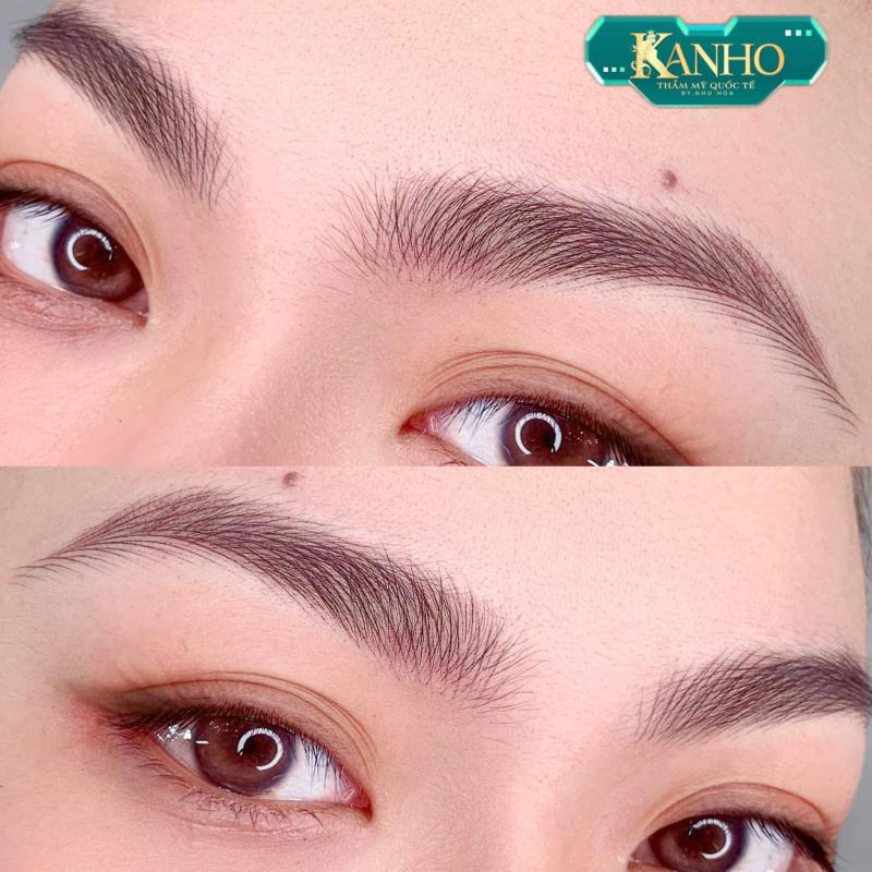 Thẩm Mỹ Quốc Tế Kanho