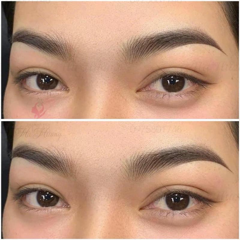 Thẩm Mỹ Viện Hà Hương
