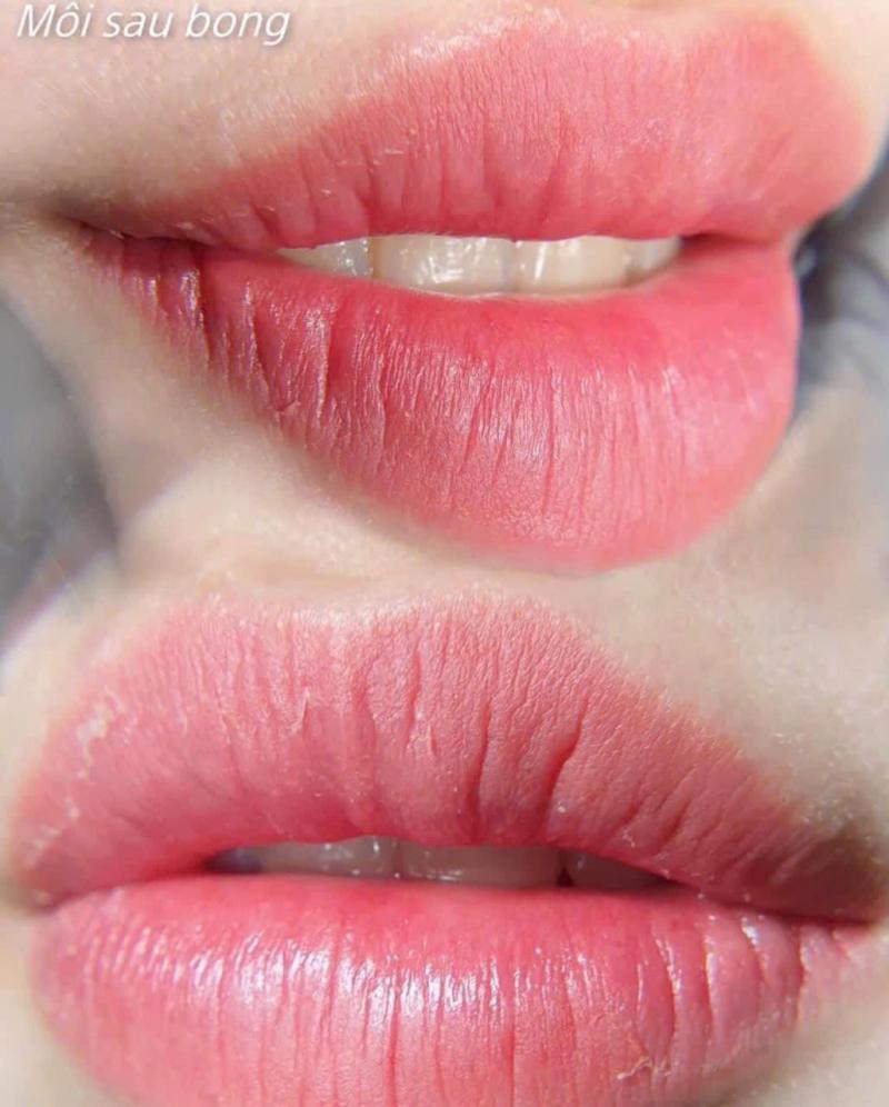 Thẩm mỹ viện Hiền Vy