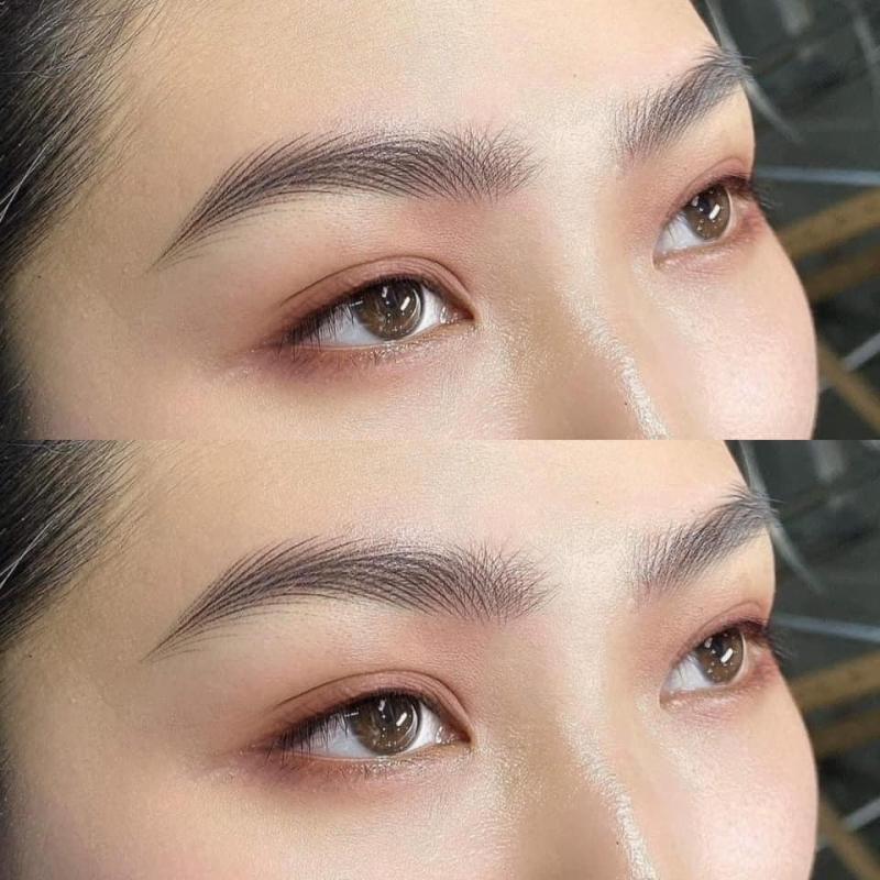 Thẩm mỹ viện Hiền Vy