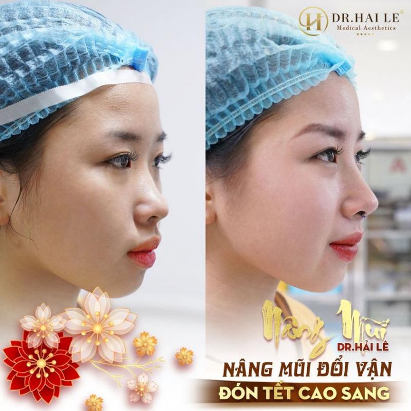 Viện thẩm mỹ Y khoa Dr. Hải Lê